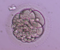 6-cell Grade II-III